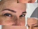 trattamenti estetica lady