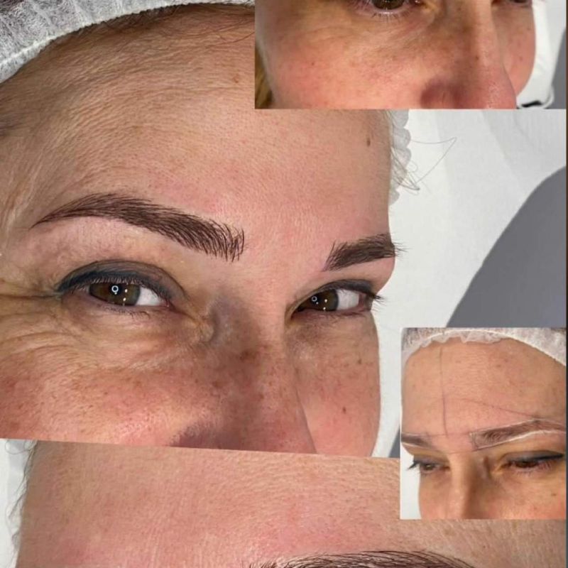 trattamenti estetica lady