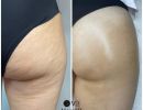 trattamenti estetica lady